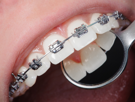 analyse orthodontie