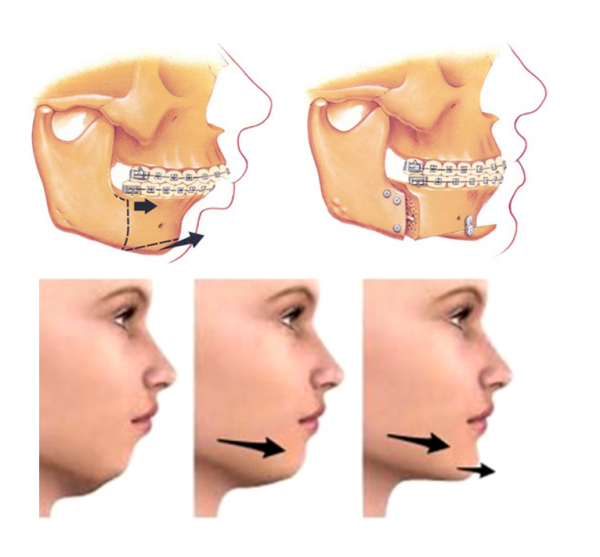 chirurgie maxilo facial